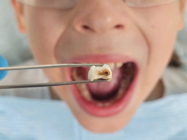 Best Pediatric Emergency Dentist in Marbury, AL